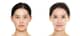 Slider image (10) JK Plastic Surgery Korea Aesthetic Surgery Clinic